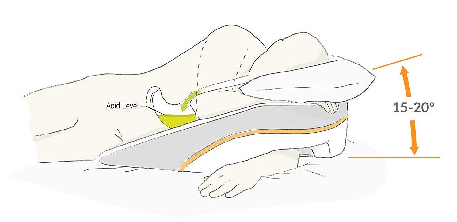 graphic showing the degrees necessary to prevent acid reflux while sleeping